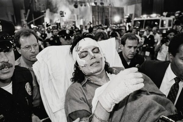 Michael Jackson’s Hair Was Engulfed in Flames for Eight Terrifying Seconds During a Commercial Shoot—Yet the King of Pop Kept Dancing, Unaware That His Scalp Was Burning as Crew Members Rushed Toward Him in Panic—But the Horrific Accident Was Only the Beginning, Because Behind the Hospital Doors Came a Life-Changing Medical Battle, a wave of pain he would carry for years, and a shocking $1.5 Million Decision that stunned the public, revealed an unexpected side of the global superstar, and forever changed the way millions remembered one of the most dangerous moments of his legendary career