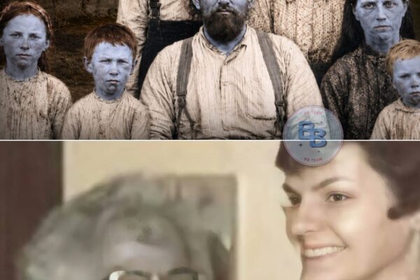 Hidden Blue People of Appalachia — The Fugate Genetic Mystery