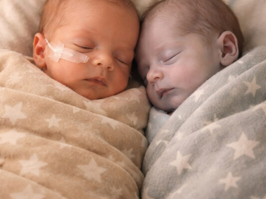 She Placed the Lifeless Baby Beside Her Healthy Twin to Say Goodbye—Until an Unbelievable Moment Left Her Break Down in Tears