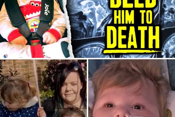 Infant’s Brain Torn & Eyes Bled Him To Death